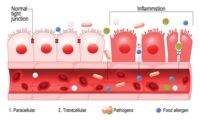 leaky gut