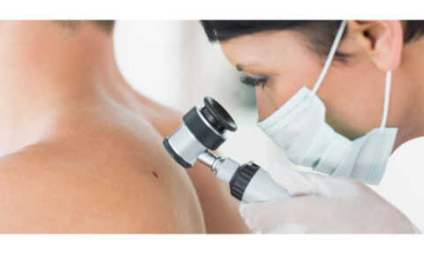 Skin Cancer Journey
