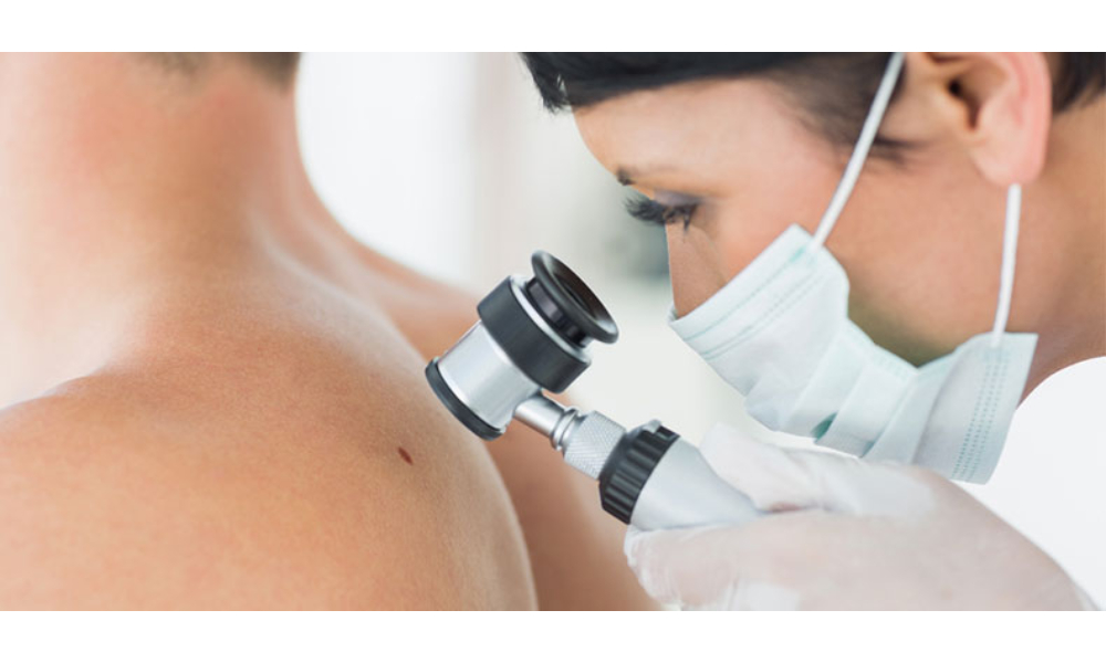 Skin Cancer Journey